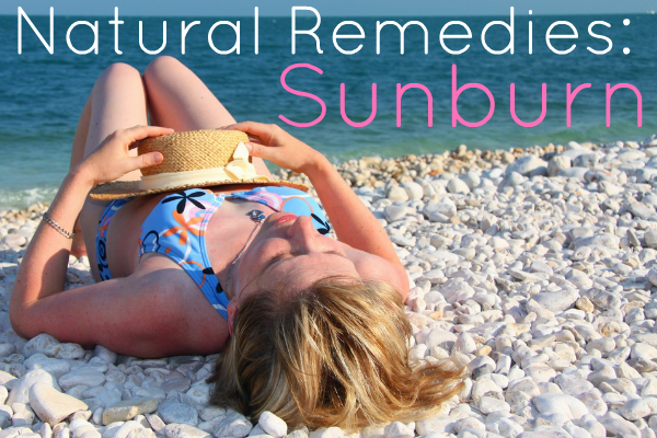 natural sunburn remedies