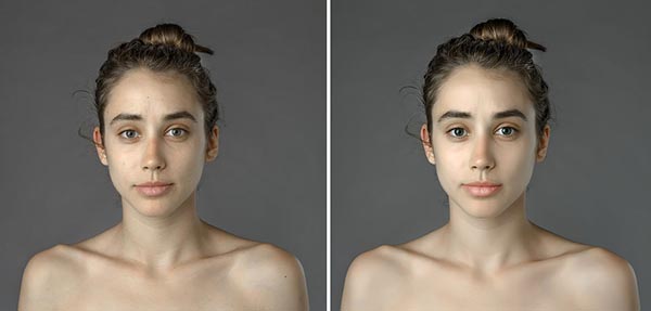 Before and After Project Looks at International Standards of Beauty